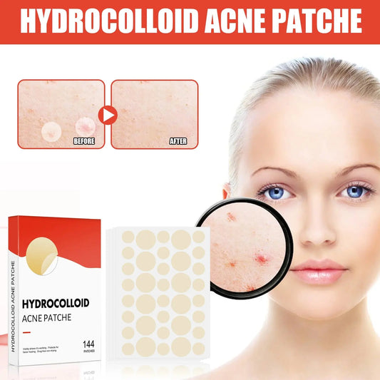 Hydrocolloid Acne Patch Invisible Closed Acne Patch Invisible Acne FacSPECIFICATIONSBrand Name: otherOrigin: Mainland ChinaHign-concerned Chemical: NoneChoice: yesJohnny TirakJohnny TirakHydrocolloid Acne Patch Invisible Closed Acne Patch Invisible Acne Face Invisible Waterproof Breathable Acne Skin Patch