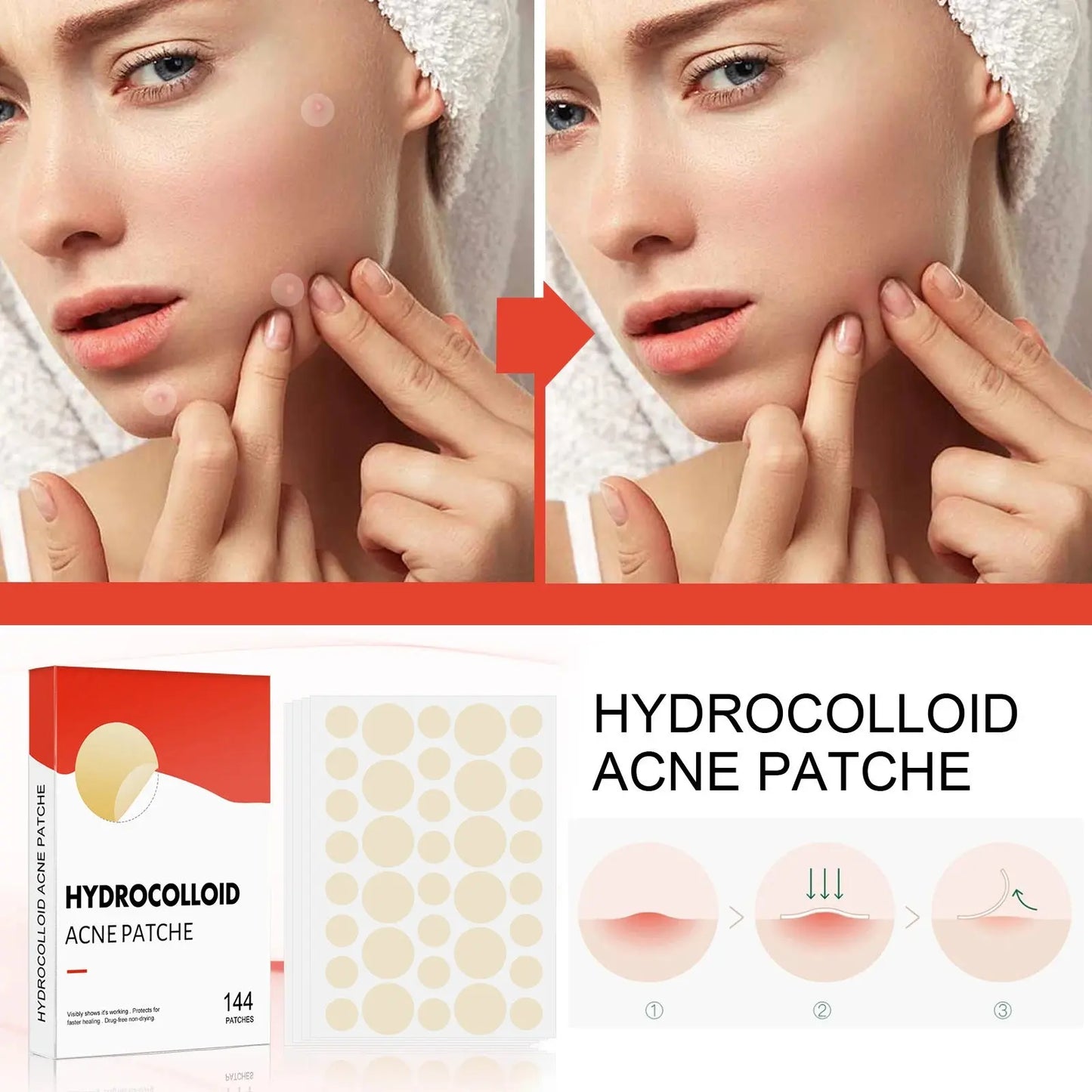 Hydrocolloid Acne Patch Invisible Closed Acne Patch Invisible Acne FacSPECIFICATIONSBrand Name: otherOrigin: Mainland ChinaHign-concerned Chemical: NoneChoice: yesJohnny TirakJohnny TirakHydrocolloid Acne Patch Invisible Closed Acne Patch Invisible Acne Face Invisible Waterproof Breathable Acne Skin Patch