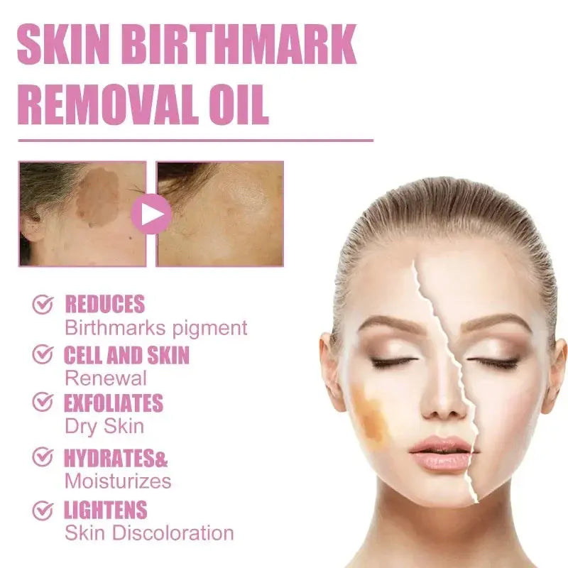 Skin Birthmark removal Serum Anti Freckle fade Pigmentation Melasma MoSPECIFICATIONSFeature: WhiteningGender: UnisexlItem Type: Face SerumFunction: Whitening, moisturizing, lightening spots, shrinking poresEffect: Anti-freckle and whitJohnny TirakJohnny TirakSkin Birthmark removal Serum Anti Freckle fade Pigmentation Melasma Moisturizing Whitening Brighten Face Care Essence Oil