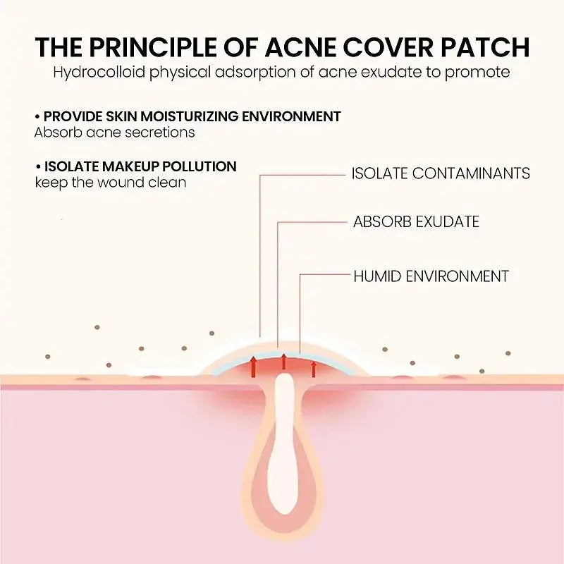 Repair Acne Patch Facial Skin Care Fade Blemishes Pimple Marks Closed SPECIFICATIONS
Brand Name: other
Origin: Mainland China
Choice: yes

 
 
 
 
 • Effective Acne Treatment :This repair acne patch is designed to effectively treat andJohnny TirakJohnny TirakRepair Acne Patch Facial Skin Care Fade Blemishes Pimple Marks Closed Acne Blemishes Cover Acne Pimple Repair Patch