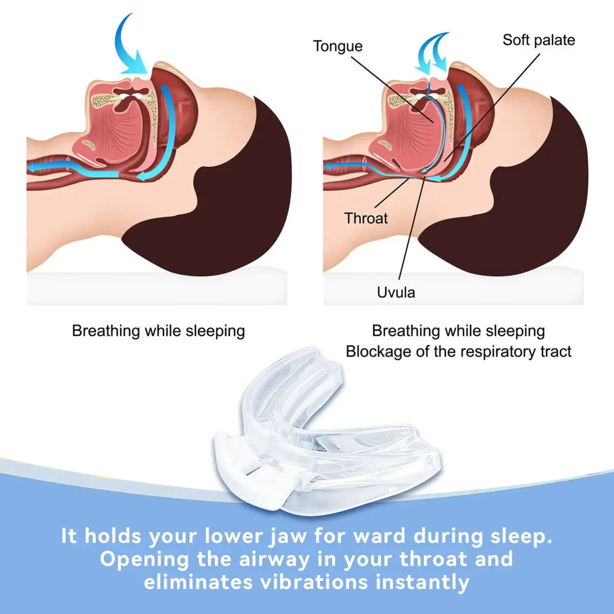 Adjustable Anti Snoring Mouth Guard Anti-Snoring Mouthpiece Sleeping DSPECIFICATIONSBrand Name: NoEnName_NullType: Anti Snore MouthpieceOrigin: Mainland ChinaWork Mode: CPAPNumber of Pieces: One UnitPressure Range: 4-20 cmH2OMaterial: Johnny TirakJohnny TirakAdjustable Anti Snoring Mouth Guard Anti-Snoring Mouthpiece Sleeping Devices Bruxism Snoring Stopper Improve Sleep Mouthpiece