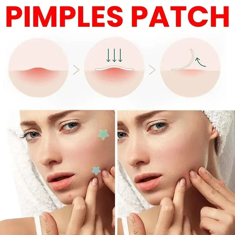 Repair Acne Patch Facial Skin Care Fade Blemishes Pimple Marks Closed SPECIFICATIONS
Brand Name: other
Origin: Mainland China
Choice: yes

 
 
 
 
 • Effective Acne Treatment :This repair acne patch is designed to effectively treat andJohnny TirakJohnny TirakRepair Acne Patch Facial Skin Care Fade Blemishes Pimple Marks Closed Acne Blemishes Cover Acne Pimple Repair Patch