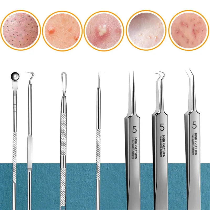 11Pcs/Set Acne Needle Blackhead Clip Remover Extraction Pore Black HeaSPECIFICATIONSBrand Name: otherItem Type: Makeup Tool KitOrigin: Mainland ChinaChoice: yesJohnny TirakJohnny Tirak11Pcs/Set Acne Needle Blackhead Clip Remover Extraction Pore Black Head Cleaner Face Skin Care Cleansing Needle Tool Cell Clamp