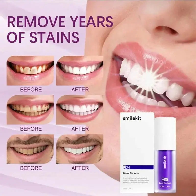 30ml V34 SmileKit Purple Toothpaste Removes Tartar Clean Oral Hygiene SPECIFICATIONSBrand Name: SmileKitOrigin: Mainland ChinaItem Type: ToothpasteNumber of Pieces: COMBONET WT: 30gAge Group: adultsChoice: yessemi_Choice: yesJohnny TirakJohnny Tirak30ml V34 SmileKit Purple Toothpaste Removes Tartar Clean Oral Hygiene Fresh Breath Whitening Teeth Care Products